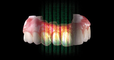 Pracovní postup se Zirkonzahn