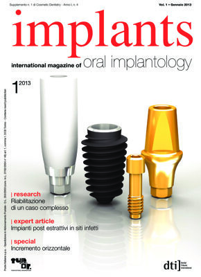 implants Italy No. 1, 2013 implants Italy No. 1, 2013