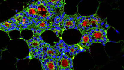 Dentale Stammzellen können milchproduzierende Zellen erzeugen Dentale Stammzellen können milchproduzierende Zellen erzeugen