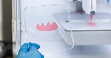 AI-enhanced 3D bioprinting enables custom oral soft-tissue grafts