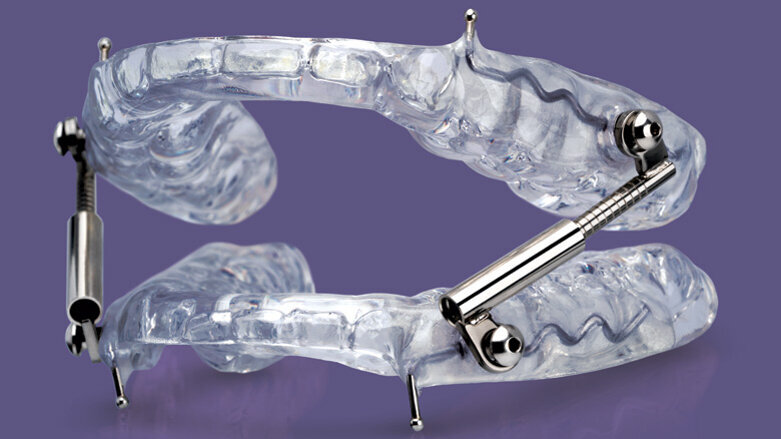 Glidewell Dental introduces a new oral sleep appliance
