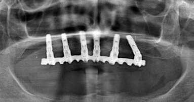 Studio pilota su 396 impianti