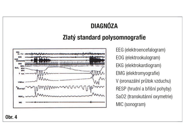 Zlatý standard v diagnostice OSAS: polysomnografie