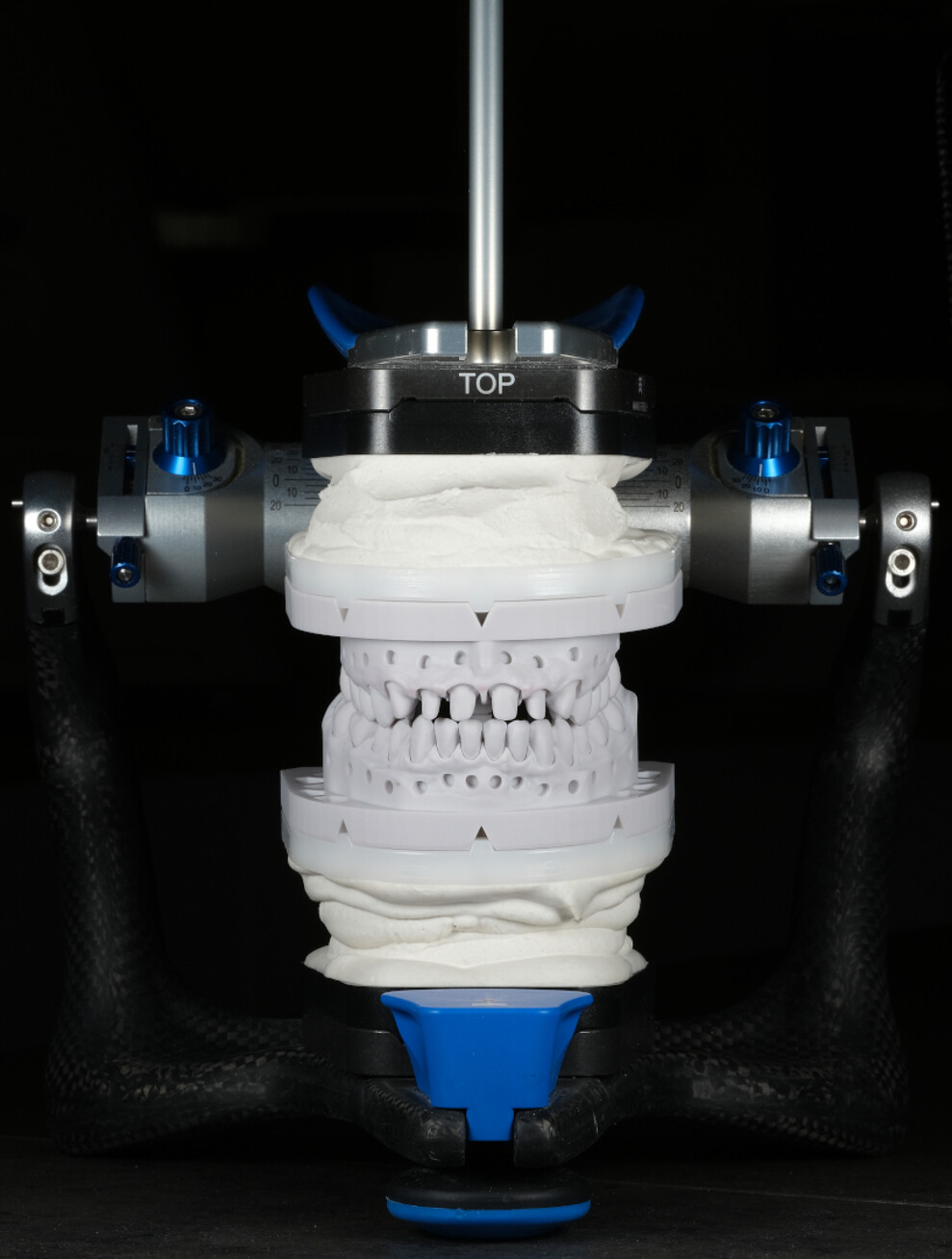 Fig. 10: Mounting of the models in the articulator.