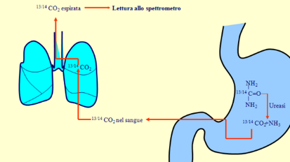 Il cavo orale sorgente di alitosi in presenza di Helicobacter pylori?