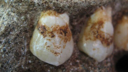 Pflanzenreste in zwei Millionen Jahre altem Zahnbelag entdeckt