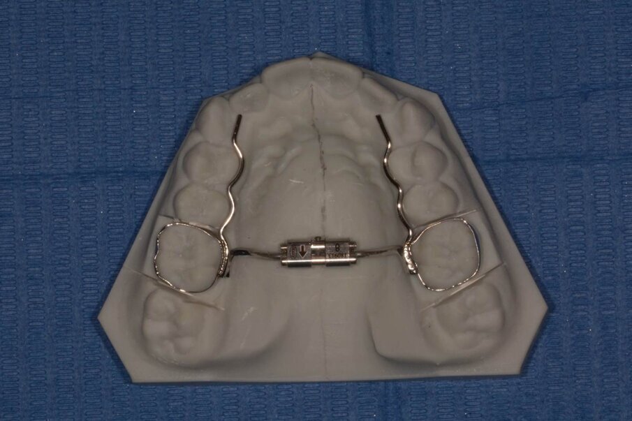 Figg. 2a-2c - Esempio di modello di lavoro ortodontico ottenuto da file .stl.