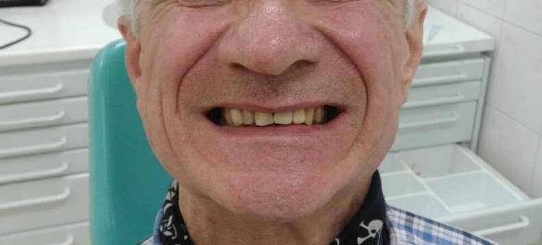 Ryc. 8_Pacjent po leczeniu.

