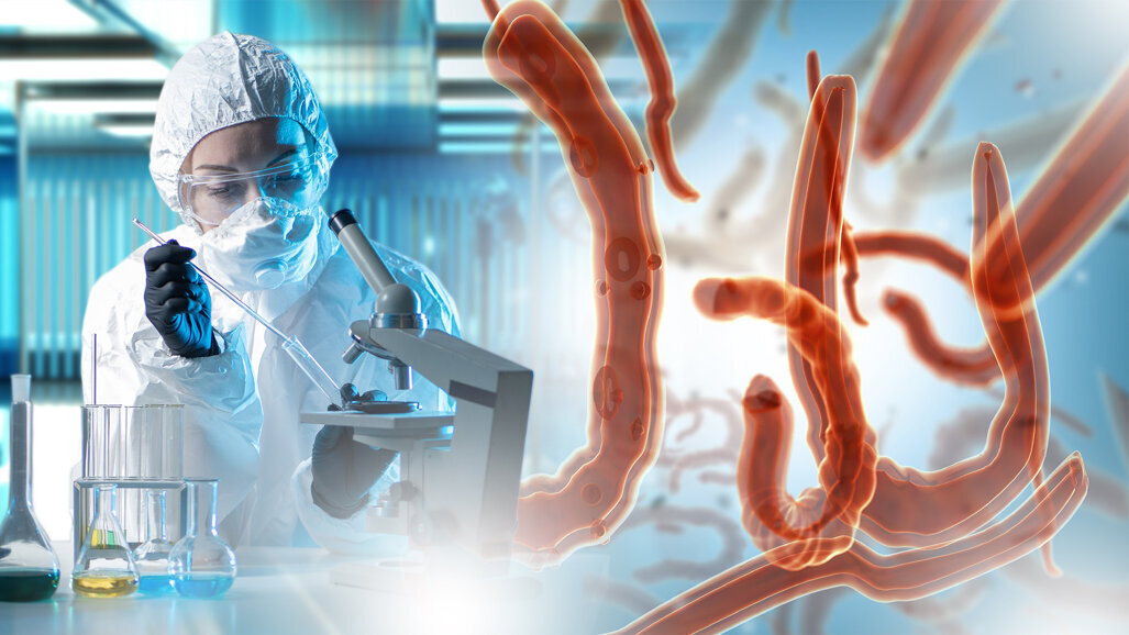 Studie zeigt Zusammenhang zwischen Darmbakterien und Karies