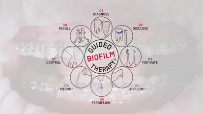 GBT and orthodontics