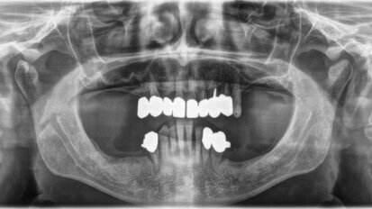 Contenzioso? No grazie! Come evitare in poche mosse rotte di collisione col paziente