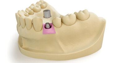 Retence získává nový význam