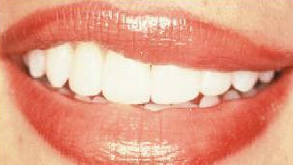 STA: essential for cosmetic dentistry