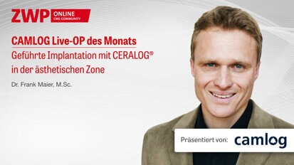 1 CME-Punkt: CAMLOG Live-OP mit Dr. Maier im Archiv 1 CME-Punkt: CAMLOG Live-OP mit Dr. Maier im Archiv
