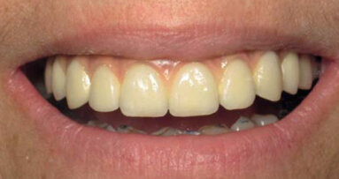 Le High Tech au service de l’implantologie