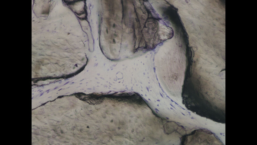 Fig. 18 - Immagine ad alto ingrandimento (400x) di una sezione istologica non decalcificata e colorata con blu di toluidina e pironina gialla.