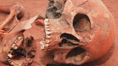 Une flore bactérienne plus riche protégeait nos ancêtres de la carie dentaire