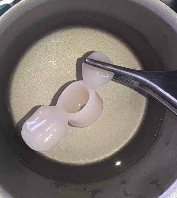 Fig. 20_L’unità di profilo personalizzato prima del suo collegamento con il cilindro provvisorio.