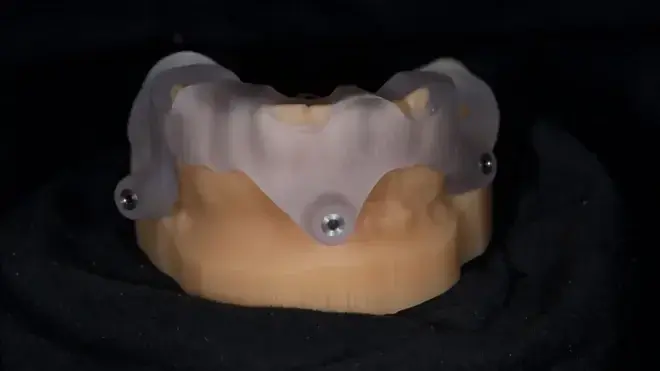 Фиг. 6: Хирургичен водач без метални втулки за подготовка на местата за пиновете. 