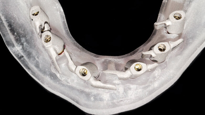 Dělený třmen jako výztuž provizorní náhrady