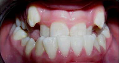 El Sistema Damon o la evolución de la especialidad