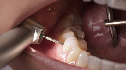 Alegra turbines: The decisive plus in performance Alegra turbines: The decisive plus in performance