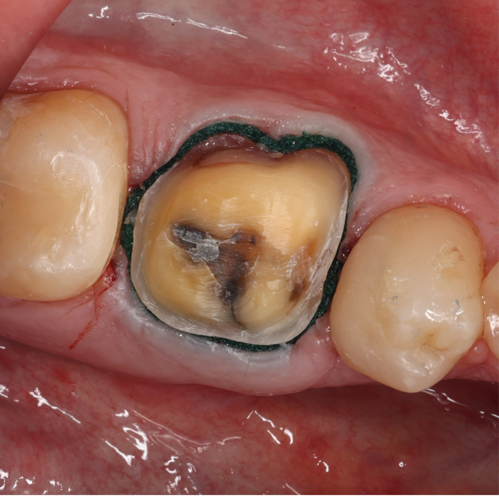 Fig. 2: Example of colour scan capture.