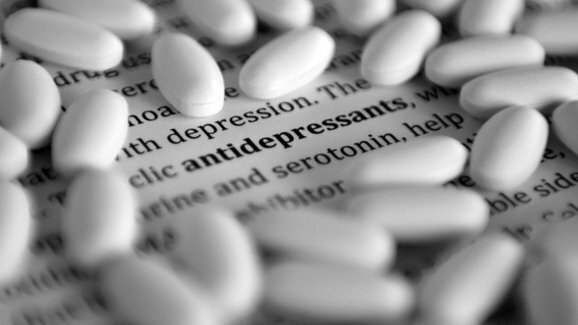 Uso de antidepressivo poderia aumentar o risco de falha em implante