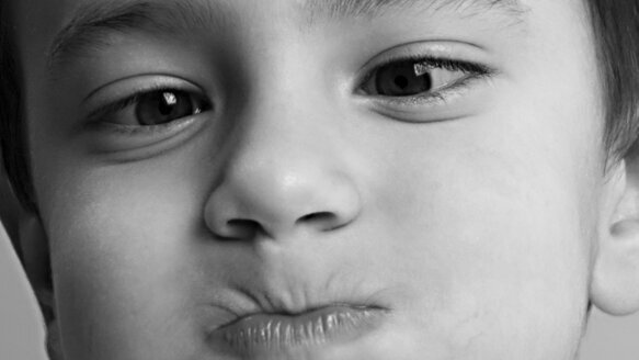 Making general anesthesia an affordable option for pediatric dental care