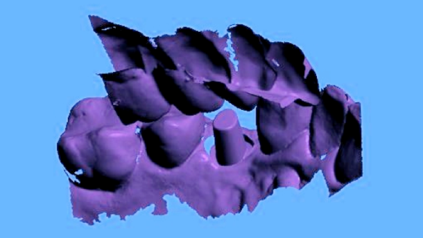 Skanowanie z poziomu implantu – część 2