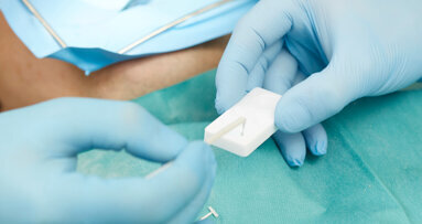 The enduring legacy of MDP monomer