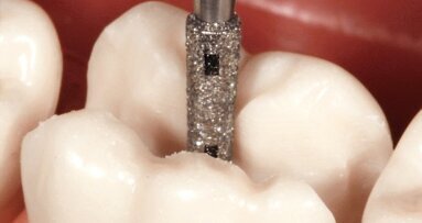 Online-Fortbildung: Keramisch präparieren heisst keramisch denken