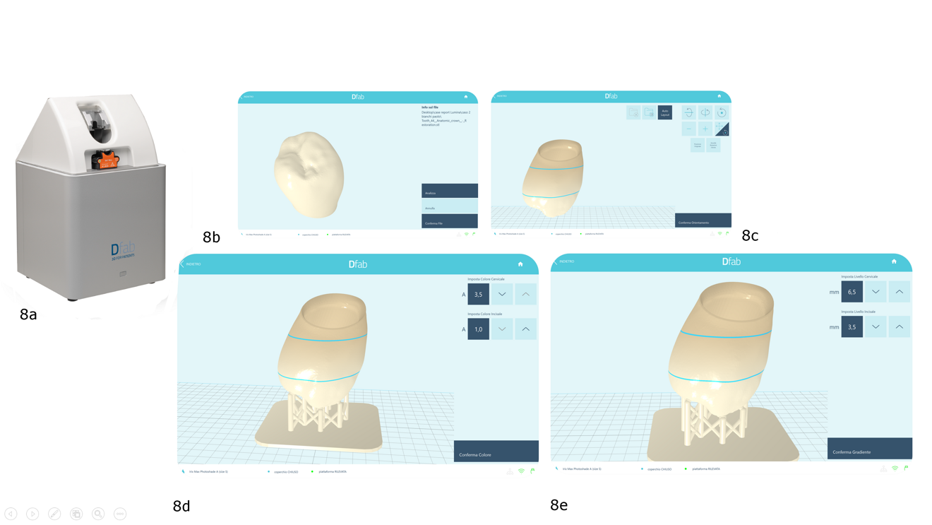 Figs. 8a–e: The operator connects the Dfab printer (a) to the laptop via USB and launches the Nauta Photoshade software, into which he or she imports the STL file of the CAD for the crown (b & c). The software automatically positions the crown and generates the supports and build base (d). The operator only needs to configure the different colour layers (e) within the software to achieve ideal aesthetics and chromatic adaptation in the patient’s mouth.