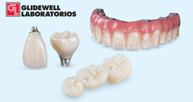 Alta estética a prueba de martillo