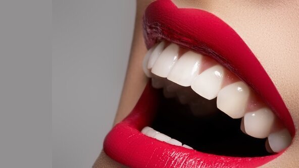 3 fakty na temat licówek