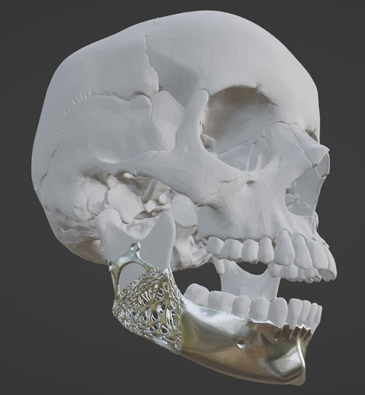 Fig 1a; Fig. 1a–i: The use of CAD software is crucial to designing a scaffold for biomaterials that will result in a bone nearly identical to that which was lost or damaged. (All images were created with the open software Blender [licensed as GNU GPL, version 3.6 LTS] by Forrest Hall) 