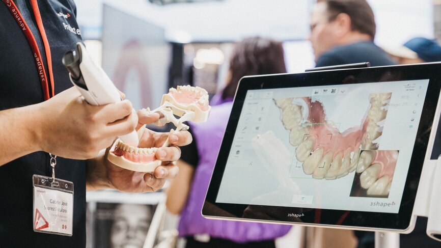 Demonstration of the 3Shape intra-oral scanner. (Image: Robert Strehler)

