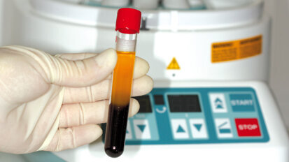 Online-Fortbildung:  Mit körpereigenen Wachstumsfaktoren Wundheilung optimieren Online-Fortbildung:  Mit körpereigenen Wachstumsfaktoren Wundheilung optimieren