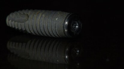 Ultrasonic scaling of titanium implants can trigger Peri-implantitis, indicates latest study