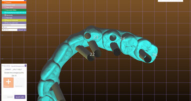 Tipy a triky pro usnadnění práce zubního technika s implantáty