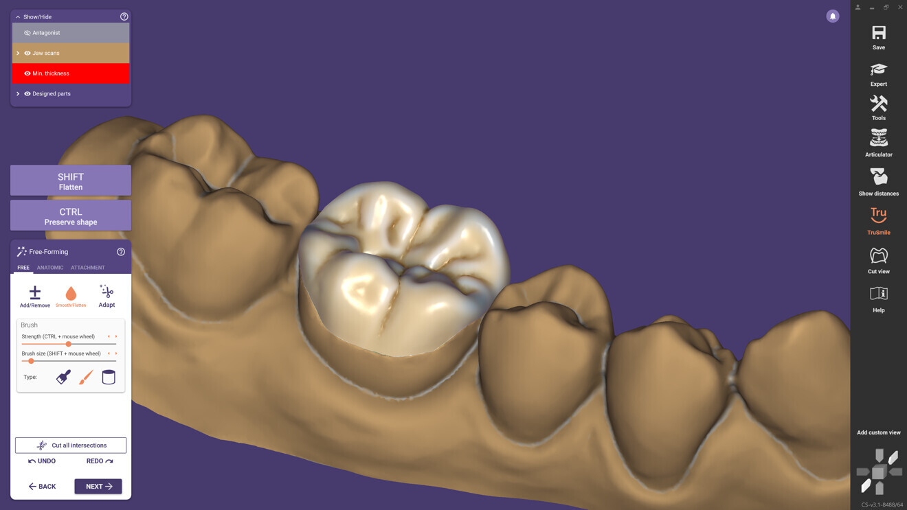 With ChairsideCAD 3.1 Rijeka, users can now create three-quarter crown designs.