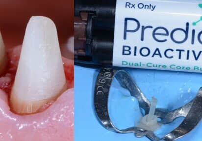 DirectaDentalGroup – Predicta Bioactive Core