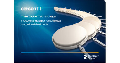 Cercon ht True Color Technology. Il nuovo standard per l'accuratezza cromatica della zirconia