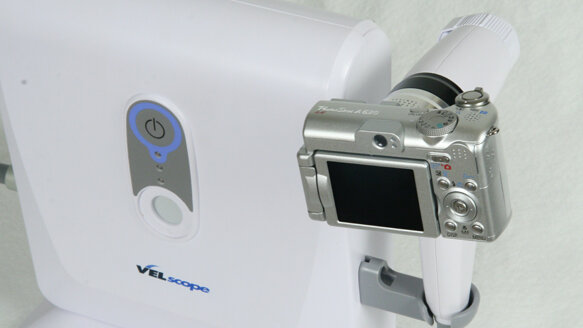 World Health Organization honors oral cancer screening device