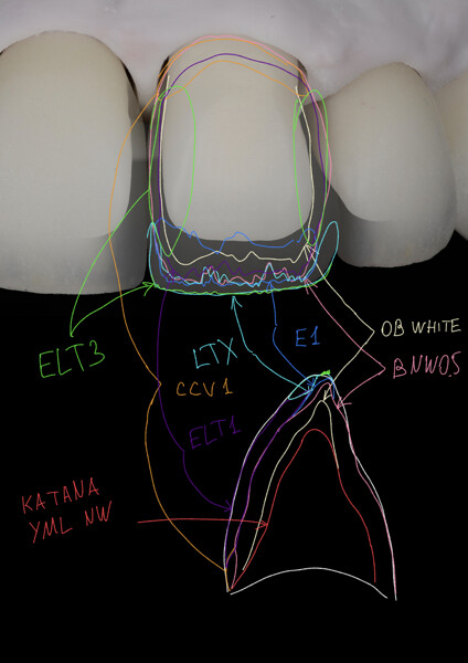 Fig. 24: Layering map of the porcelain layers.