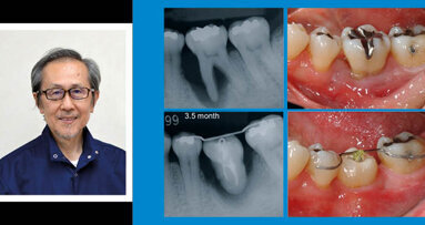 Световният експерт по автотрансплантация д-р Мицухиро Тцукибоши идва за първи път в България