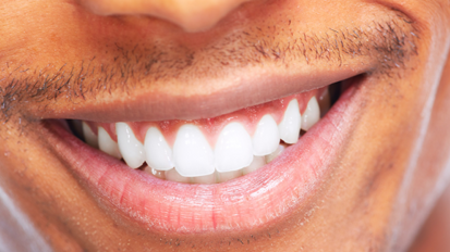 Auch hinter Gittern weiße Zähne