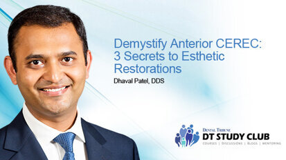 Уебинар: Разкрийте тайните на естетичните възстановявания на фронталните зъби със CEREC