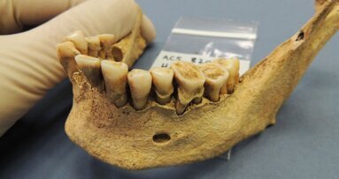 Проучване показва, че преминаването към съвременната диета засяга оралното здраве