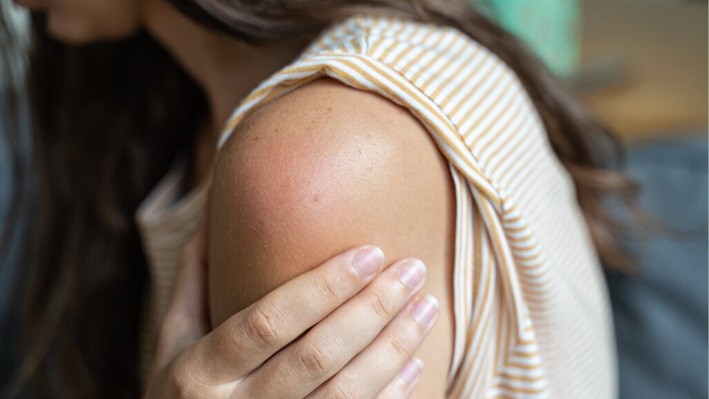 Verdachtsmeldungen unerwünschter Impfreaktionen veröffentlicht